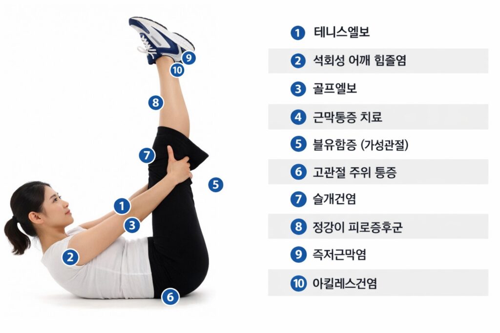 shockwave therapy 체외충격파 치료 등마루신경외과